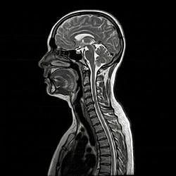 MRI / BNB