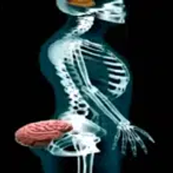 assbrain / SOL