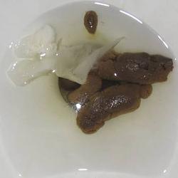 POO / SOL