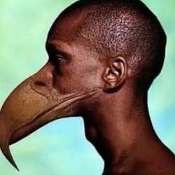 dickhead