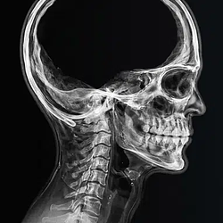BRAINLESS