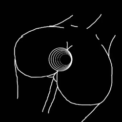 Black Hole