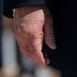 HAND
