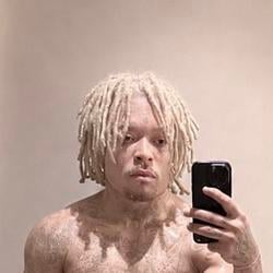 bleached