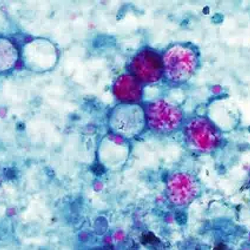 Cyclospora / SOL