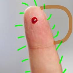 POD