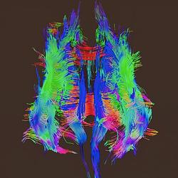 BRAIN
