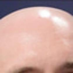 BALD