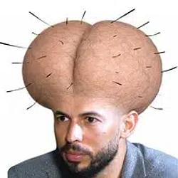 Prostate