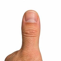 $Thumb