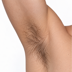 ARMPIT