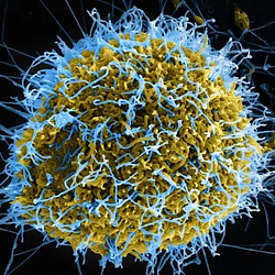 Ebola Virus