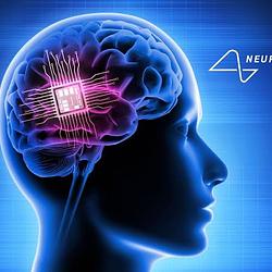 Neuralink