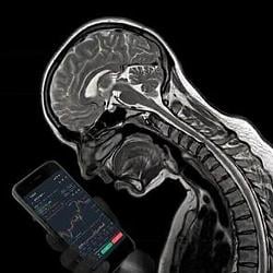 MRI / BNB
