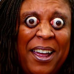 Eye