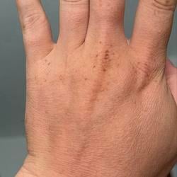 HAND
