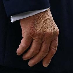 Hand