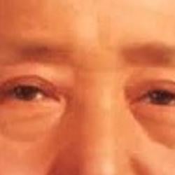 MAO