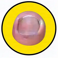 TOEKEN