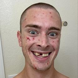 Crackhead