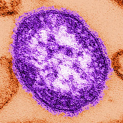 measles