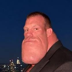 Chin
